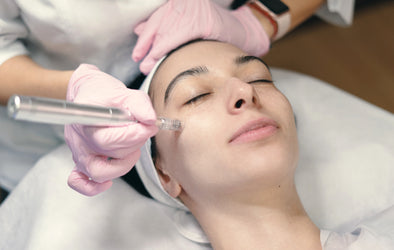 1 Microneedling session