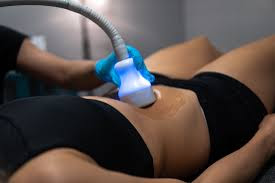 Beauté Cryo  body contouring